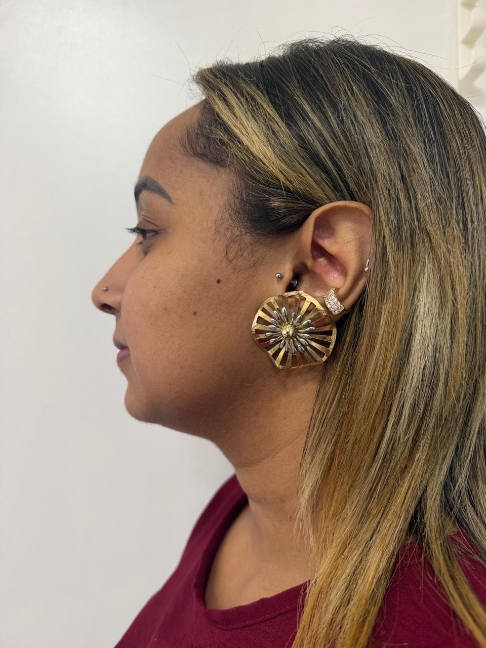 Perfil da paciente antes da harmonização facial na Apapele
